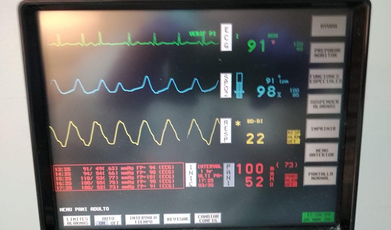 Imagen tomada durante el ensayo realizado con éxito en un paciente del Hospital de Antequera.